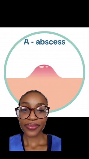 Understanding Abscess: Causes, Symptoms, and Treatment Options