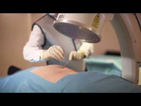 Praxisbeispiel Infiltration