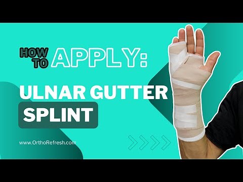 How To Apply an Ulnar Gutter Splint for a broken hand / Boxer's Fracture