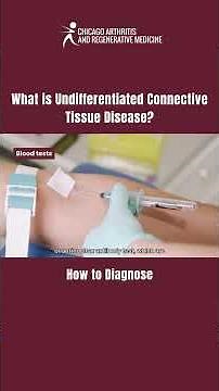 How to diagnose UCTD (Undifferentiated Connective Tissue Disease)? #Rheumatology