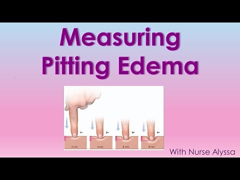 How to measure Pitting Edema