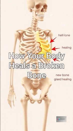 How Your Body Heals a Broken Bone | Bone Healing Process Explained #science#biology
