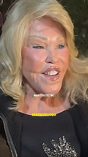 Matias Durant on Instagram: "#parati #chisme #surgery"