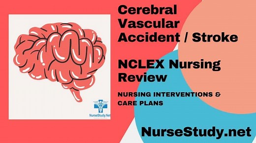 Stroke Nursing Diagnosis & Care Plan - NurseStudy.Net