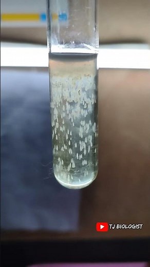Thioglycollate broth | stalactite growth | microbiology| Enrichment medium| tjbiologist laboratory