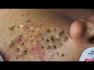 Enjoy Every Day With The Best Video Loan Nguyen Spa #57905