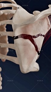 How do scapular body fractures affect shoulder function? 3D visualization Scapular body fractures are rare injuries that usually occur after high-energy trauma such as car accidents or severe falls. Most of these fractures are managed conservatively with rest and physical therapy, since the scapula has strong surrounding muscles that support healing. 🔹 Surgery is only required in cases of severely displaced fractures.🔹 Early range of motion exercises are essential for regaining shoulder streng