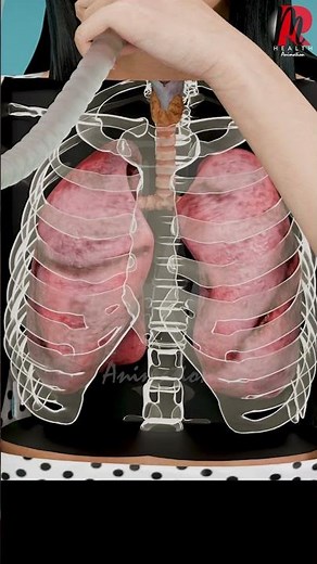 The Truth About Incentive Spirometry (Doctor Explained)