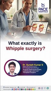 What is Whipple Surgery? | Basics of Whipple Surgery #whipplesurgery
