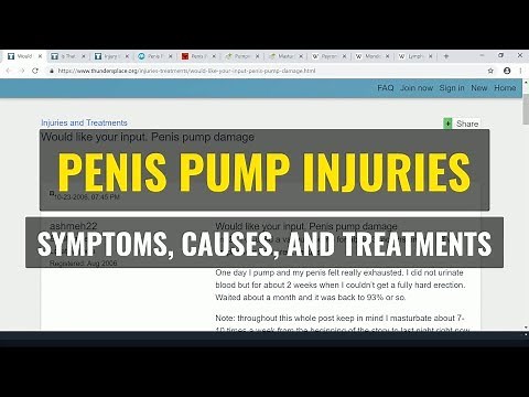 Penis Pump Injuries | Symptoms, Causes, and Treatments