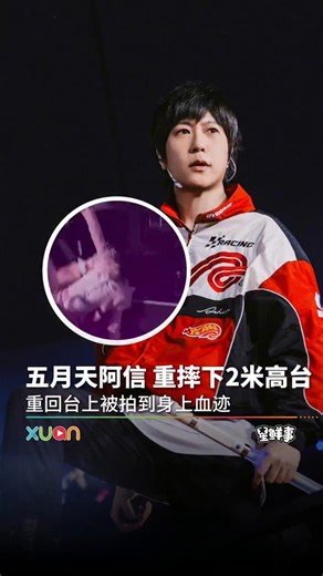 ASTRO XUAN on Instagram: "#一个人唱K：单看画面就觉得阿信那一下摔得好重啊！幸好我们的主唱大人最后报平安没事啦，大家都要好好的！！！ #XUAN #阿信 #坠台 #FOREVER恒星之城巡回演唱会"