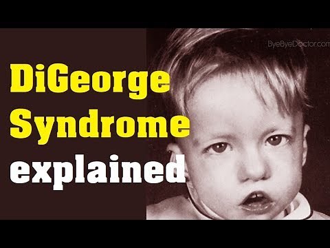What is DiGeorge Syndrome - Cause and Treatment