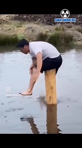 154K views · 968 reactions | Cases of Trauma Surgery and how they happen | Medical Talks | Facebook