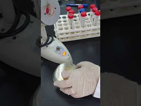 Effect of pH on bacterial growth