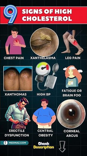 High Cholesterol Symptoms: What Your Body Is Trying to Tell You