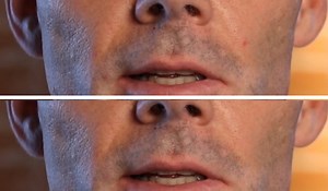 How to Quickly Retouch Skin in Adobe After Effects