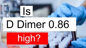 Is D Dimer 0.86 high, normal or dangerous? What does D Dimer level 0.86 mean?