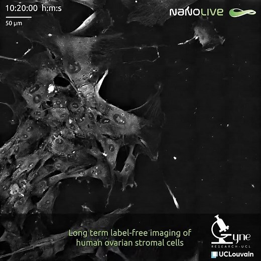 Dynamic cell culture