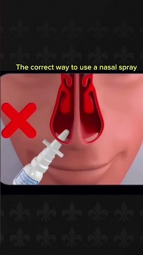 The correct way to use a nasal spray #nose #spray