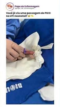 Passagem de PICC na UTI neonatal