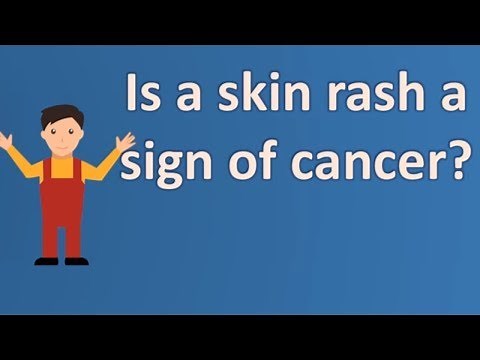Is a skin rash a sign of cancer ? |FAQS on Health