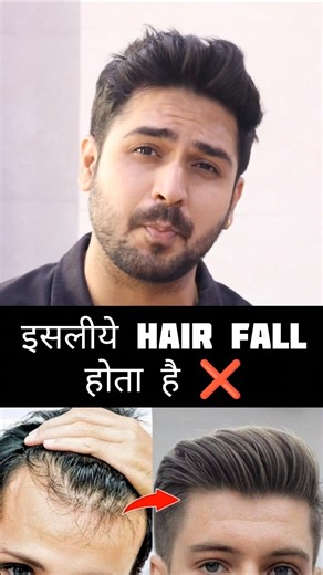 Hair fall mistakes | how to stop Hair fall #hairfall #hair #shorts #festivewithshorts