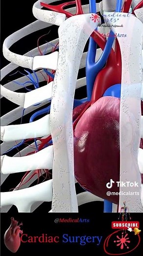 Open heart Cardiac Surgery Heart Bypass