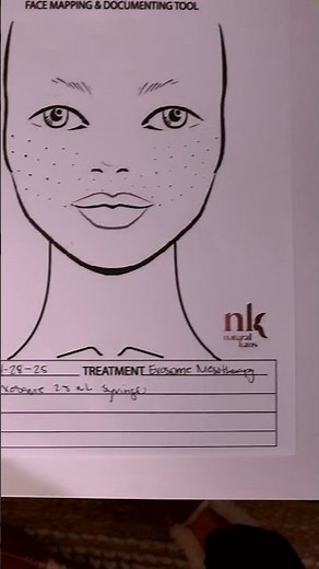 face mesotherapy with Aqua Exosomes