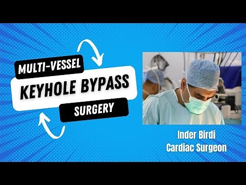 Recovery After Triple Bypass Surgery: Quicker With Keyhole Heart Bypass