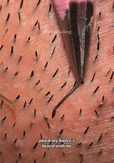 Plucking My Fiancé's Beard Hairs Together