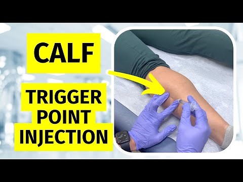 Calf Trigger Point Injection Technique