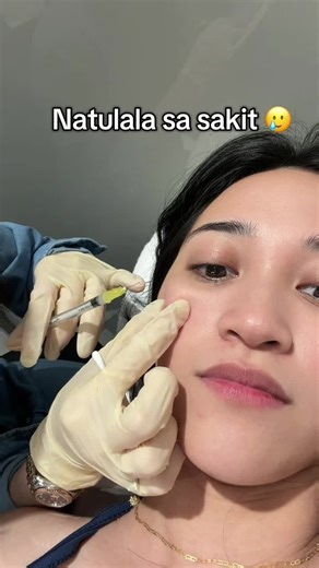 Wala na talaga yung pinple ko after 5 hours ❤️😱 #fyp #kcvictoria #fypシ゚viral