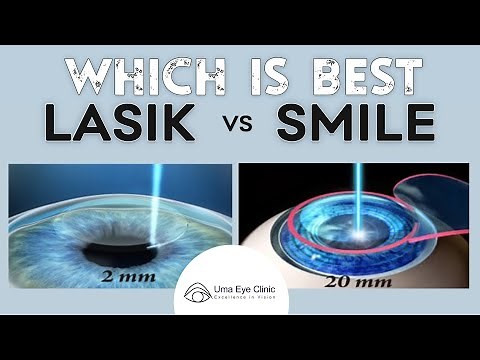 Laser Eye Surgery: Lasik vs Smile | Dr ArulMozhi Varman | Uma Eye Clinic