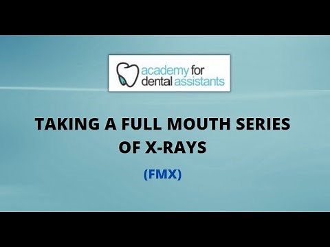 FMX (Instructional Guide on how to take X-Rays)