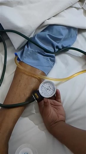 Ankle-Brachial Pressure Index (ABPI) is considered as an easy &amp; effective non-invasive procedure to predict potential Peripheral Arterial Diseases. It's a comparison between blood pressure of ankle &amp;… | Dr. Ashfaq Rahman