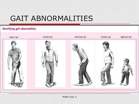 Types of Gait Abnormalities ; Antalgic, Ataxic, Shuffling, Steppage, Waddling, Festinating, Scissors
