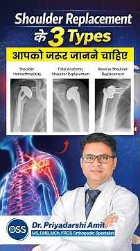 Types Of Shoulder Replacement Explained by Dr. Priyadarshi Amit
