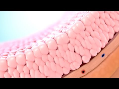 Understanding Bladder Cancer