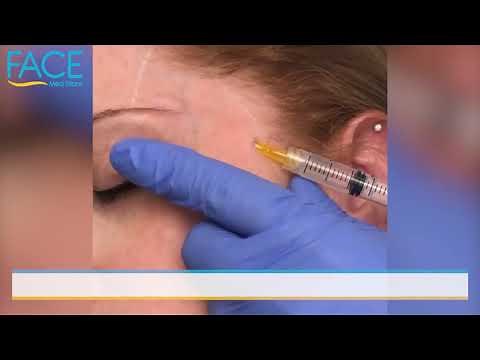 How To Inject Dermal Filler Into The Temples With a Cannula
