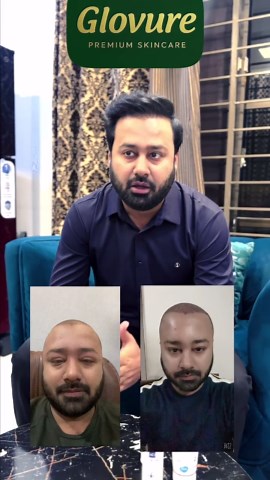 Full Hair Regrowth Kit for Strong and Thick Hair