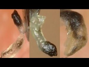#35~Blackheads • Nose Blackheads • Blackheads 2021 New • Blackheads On Nose • Blackheads Nose