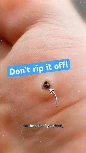 Don't Rip Off That Bump