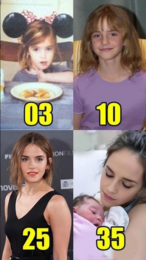 Emma Watson Age Transformation From 1 To 35 Years