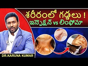 Lumps in Armpits and Neck (Telugu) | Dr Karuna Kumar