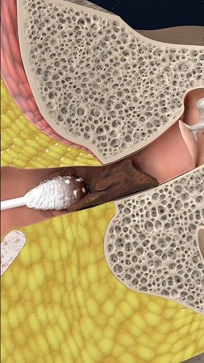 Earwax buildup explained in 3D: how cerumen impaction forms 🦻 #3danatomy #humanbody