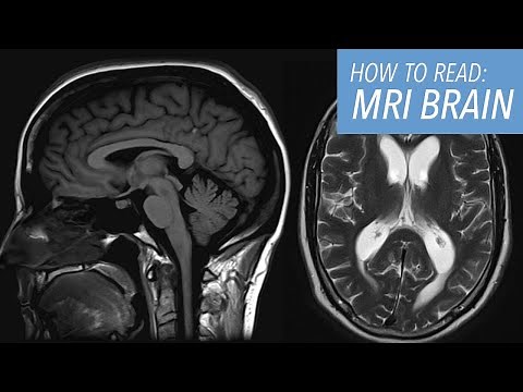 How to Read an MRI
