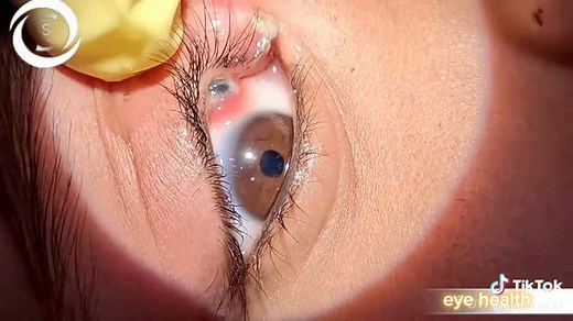 Charles Leclerc Heterochromia: Exploring Eyes Without A Face