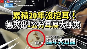 2.2M views · 304 reactions | 雖然很噁心，但越看越療癒σ`∀´)σ (#抹邊編) 影片授權：Ines 宜內斯 完整影片看這邊→https://youtu.be/1Q3panGVW-g #掏耳 #採耳 #耳結石 #20年 #陳年耳屎 | 中時新聞網 | Facebook