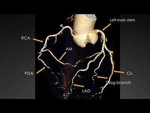 CT Coronary angio processing