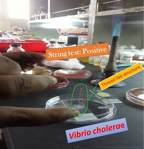 String test: Principle, procedure, Result and interpretation